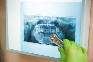 Dental x-ray services - Riley Dental Group